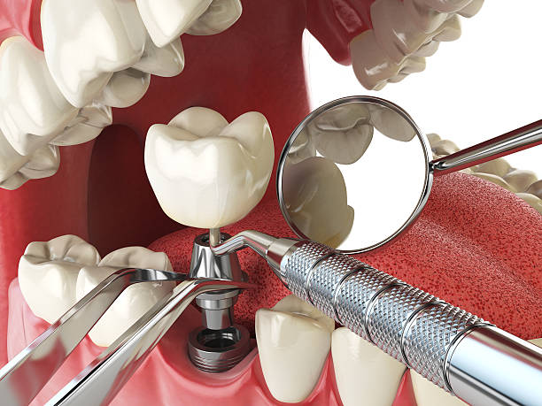Best Emergency Dental Care for Trauma or Injury in Chillum, MD